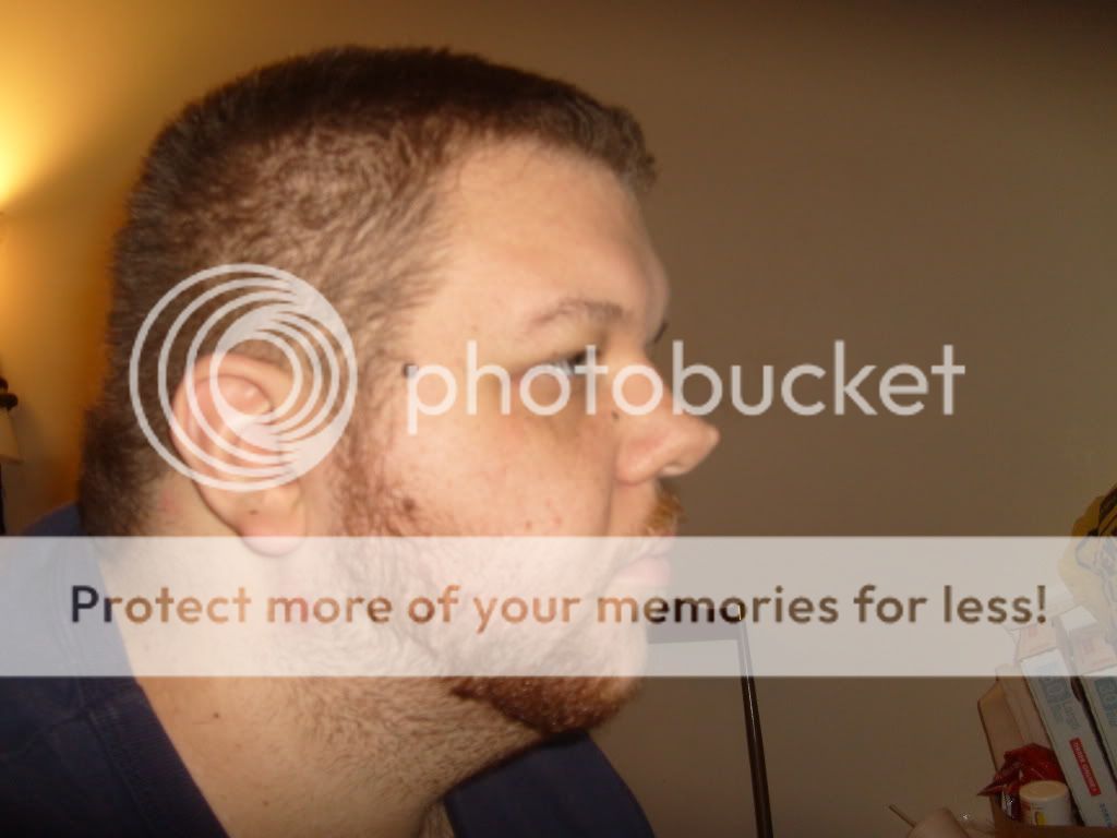 I Hate My Nose...... :( Photo by wyrdmage | Photobucket